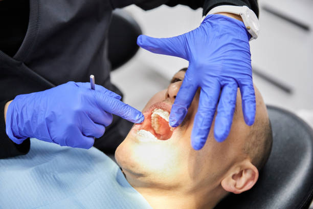Best Emergency Denture Repair in Montesano, WA